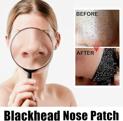 Nose Blackhead Strips